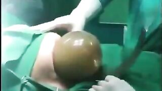 During a routine C-section, doctors witnessed something incredibly rare.