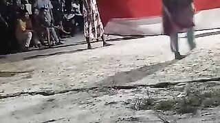 OMG🤯🤯 IS HURT????? Lol