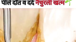 Yellow teeth problem solve