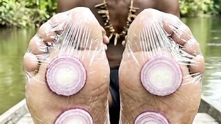 Benefits of onion