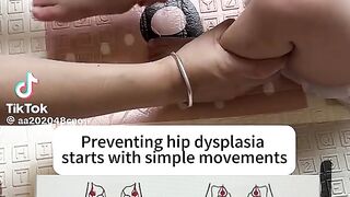 Keeping your babies leg healthy