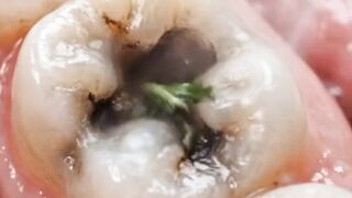 Don't forget clean your teeth