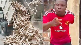 Human Bones