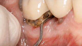 Dentist 3