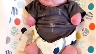 Parents' Love Creates A Miracle For A Limbless Child#love #miracle #parents (4)