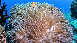 Clownfish Swimming Among Giant Sea Anemone on Tropical Coral Reef 4K Vertical