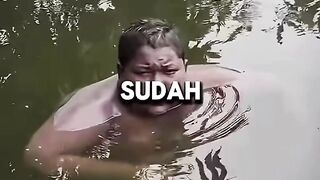 Gara-Gara Kulit Terasa Terbakar, Remaja 16 Tahun Ini Pilih Berendam di Kolam Selama 5 Tahun 🌊😳