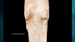 Tulangmu Bisa Menguat atau Melemah Sendiri‼️