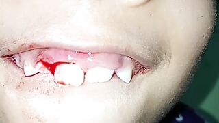 arrancando o dente sozinha