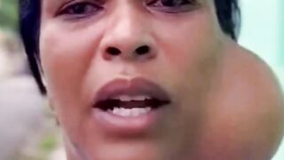 Notícia mulher com câncer raro vamos orar por ela