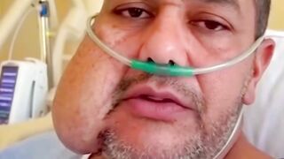 Notícia homem com câncer vamos fazer oração