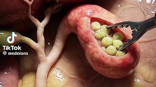 All about human fertilization 2