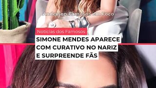 Simone Mendes aparece com curativo no nariz e surpreende os fãs