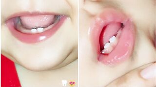 Cute teeth