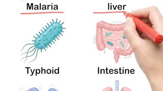 Diseases &signs