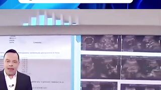 Bizarre News #BizarreNews #Viral 399