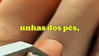 Why do marathon runners remove their toenails? The reason is shocking!