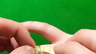 How to remove ring from finger| Life hacks