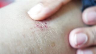 DERMATOLOGY 2