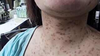: Waxing Problems & Solutions | Common Waxing Mistakes Every Beautician Should Know