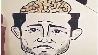Brain operation