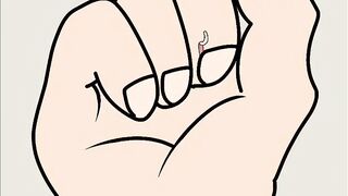 It’s Hurt