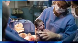 Bizarre News #BizarreNews #Viral 945