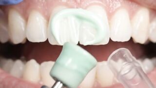 Teeth treatment 2
