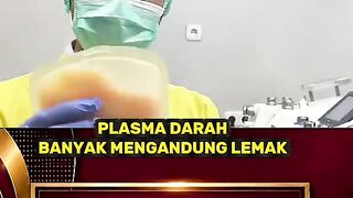 Plasma darah