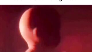 Asista