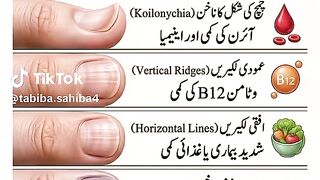 pnakhan ko dekh k bemari ka pta