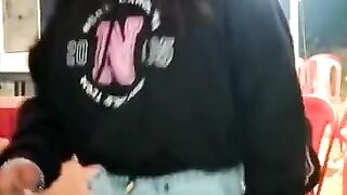 Love bite