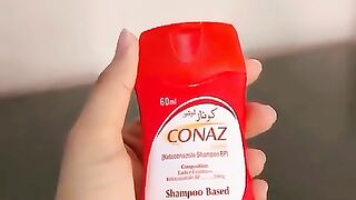 **Conaz Shampoo Honest Review 🧴✨ Kya ye waqai dandruff ke liye effective hai? 👀 Mera honest experience video mein!