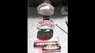 beautiful lower dentures