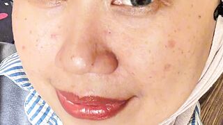 Panthenol cream for damaged skin barrier, repair skin barrier