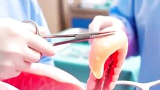 Apendicitis: cómo comienza la inflamación y cuáles son sus principales señales
