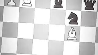 The Most Challenging Chess Position.. ♟️💎 | Magnus Carlsen Brilliancy