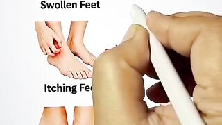 KENALI SINYAL TUBUH, JANGAN ABAIKAN KESEHATAN KAKI