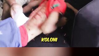 BOCIL KESURUPAN DISERANG SEMUT?! 😱 #shorts