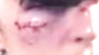 Jake McCabe hit by High Stick in Maple Leafs’ win