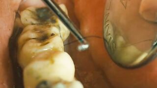 The Dentist Pulled Out a Hair… and Unleashed a Terrifying Nightmare! 😱🦷