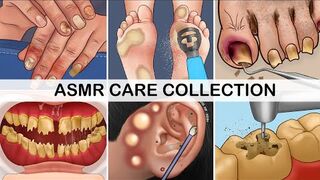 ASMR/Nose treament and ear treatment asmr video |ASMR Animation|