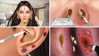 ASMR/Ear treatment animation Video | asmr animation |