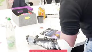 wounded Ukrainian soldiers with bionic arms