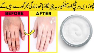 How to Whiten your Hands & Feet | Hands Whitening Remedy | Home Remedy