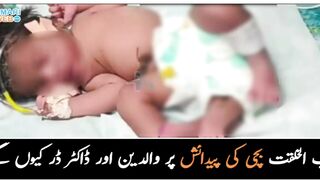 Parents and doctors were also afraid of the birth of a strange baby girl, then what happened/Info TV