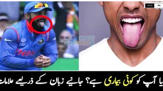 Zubaan Ka Rang Tabdeel Q Hota hai ?/Info TV