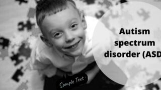 Autism spectrum disorder. DSM 5