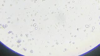 lacto bacteria ????????