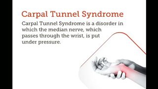 Carpal Tunnel Syndrome